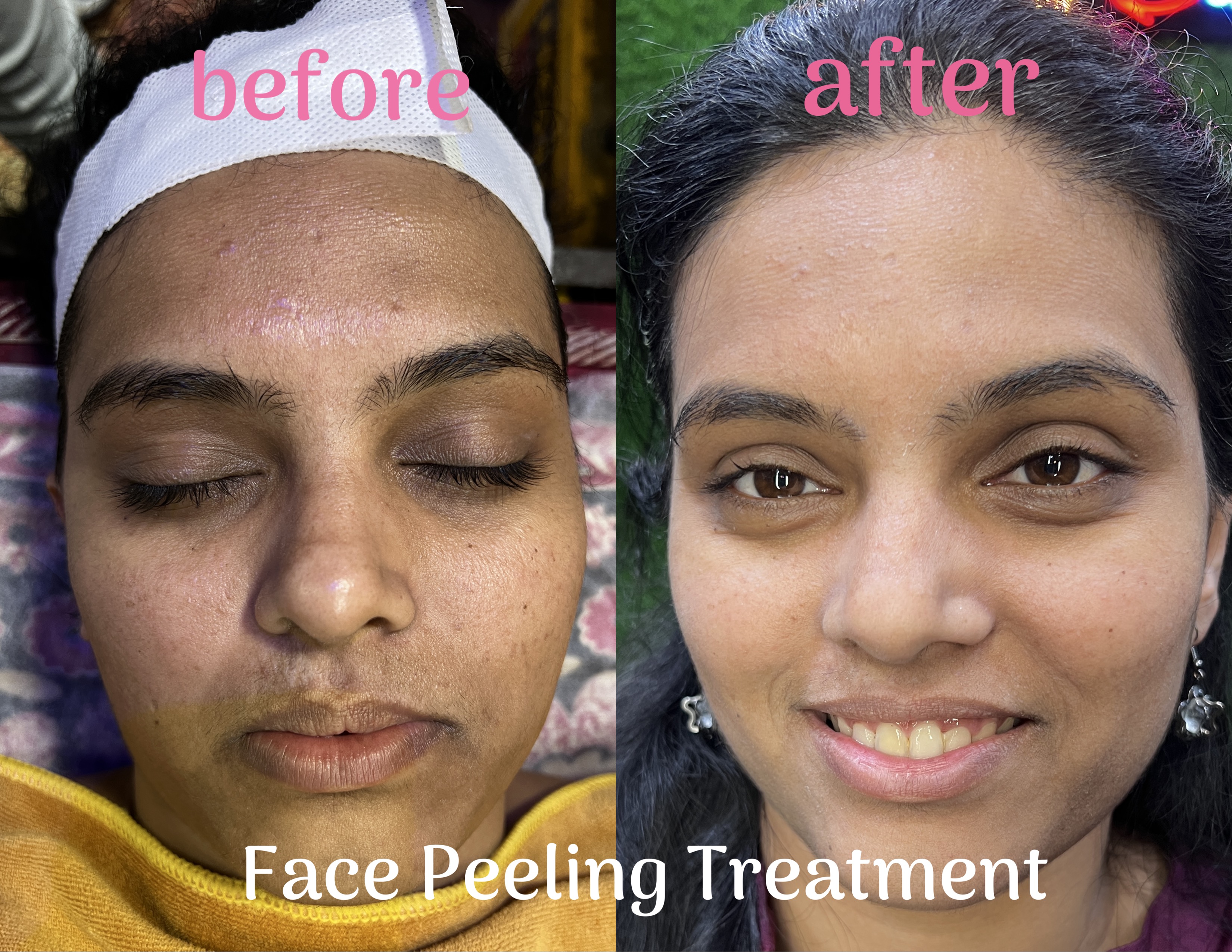 Anti-aging treatment at Sneha Beauty Parlour Kalyan East